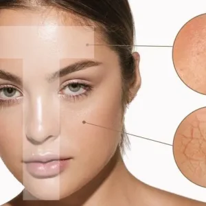 بهترین روتین پوست مختلط