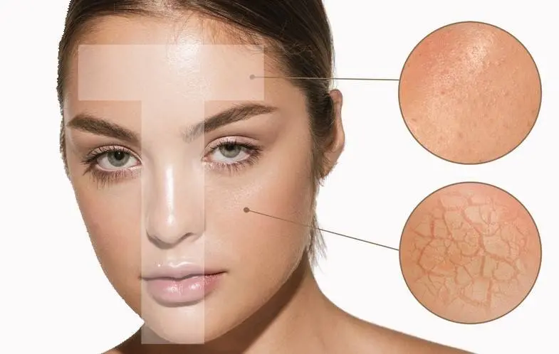 بهترین روتین پوست مختلط